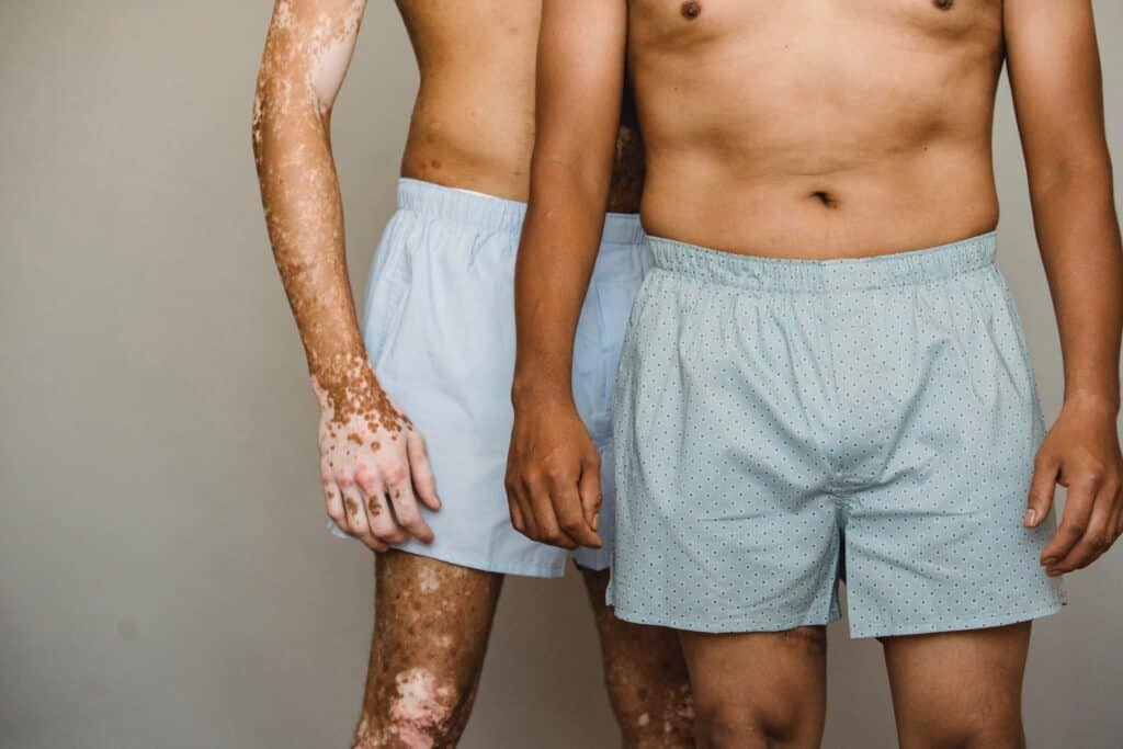 two men wearing boxer shorts